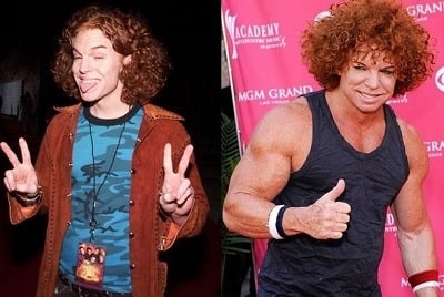A picture of Carrot Top before (left) and after (right).